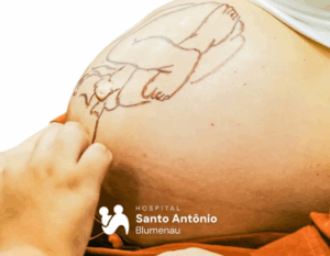 hospital santo antonio 4